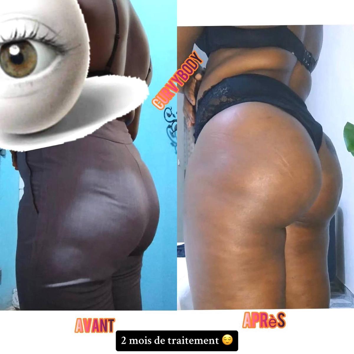 Curvy Body Temoignage